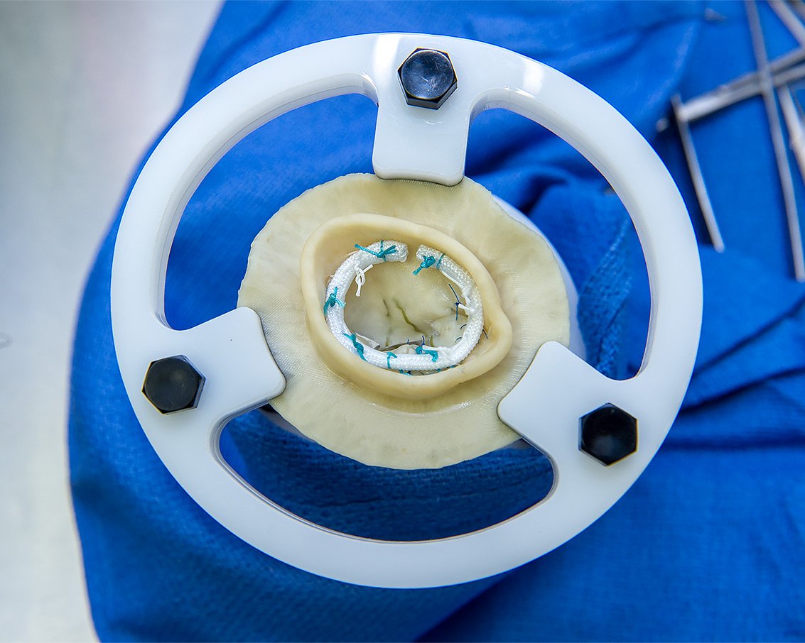 A synthetic mitral valve used for training